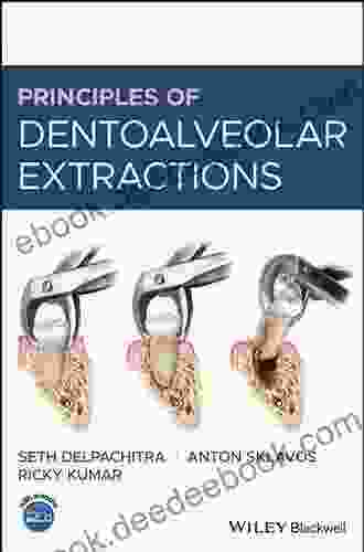 Principles Of Dentoalveolar Extractions Catherine Silas